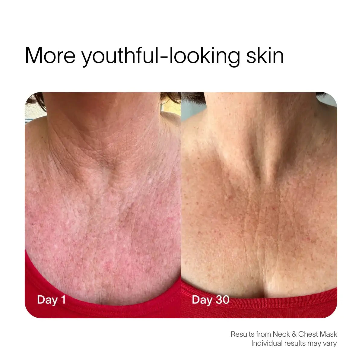 Solawave Neck & Chest Rejuvenating Mask
