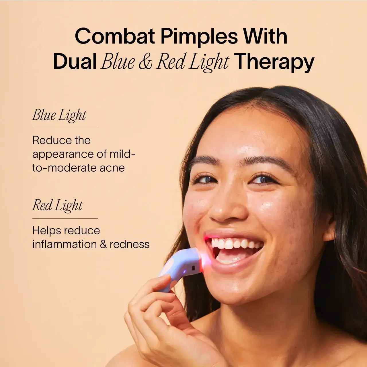 Solawave Bye Acne: 3-Minute Pimple Spot Treatment
